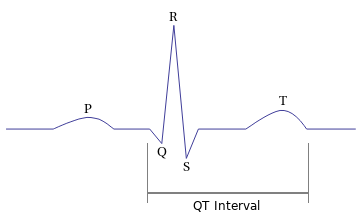 Sinus rhythm diagram