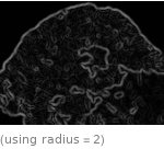  (using radius=2)